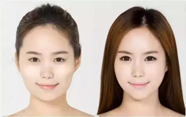 你以为肉毒素只能用来瘦脸?tooyoung