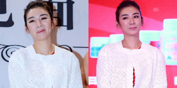 玻尿酸填充法令纹脸僵硬多久,打玻尿酸脸会僵硬吗