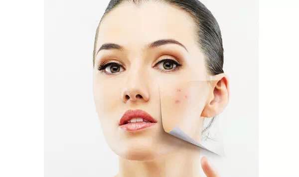 挤了多年的痘痘，你知道挤出来白色的物体是什么吗？