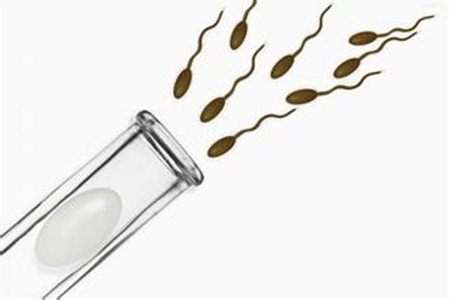 无精能做试管吗,无精做试管的可以做双胎吗