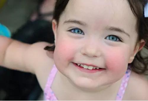 孩子四个地方变红家长一定要重视,爸妈看宝宝反应