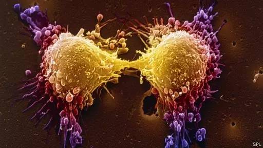 滚蛋吧肿瘤君：一文带你看懂肿瘤君的发生与治疗对策