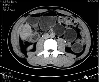 鐥呯悊鍒囩墖闃呯墖澶ц禌,鐥呯悊闃呯墖姣旇禌