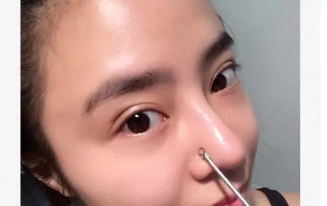 痘痘痘印黑头日常推荐,去黑头痘痘教程