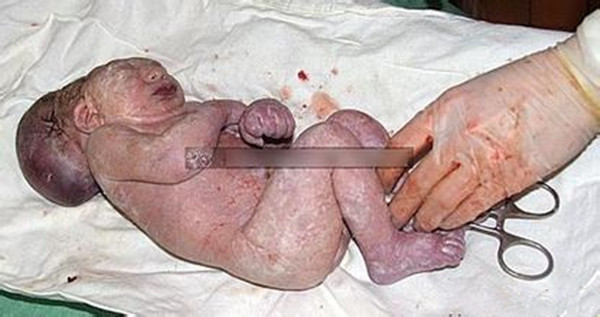 戒毒后怀孕对胎儿有影响,吸毒者戒毒后能生孩子吗