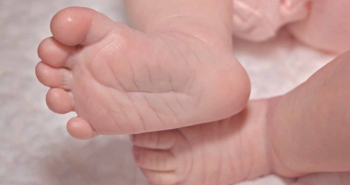 宝宝润肤露夏季,宝宝冬天皮肤干燥用什么润肤露好