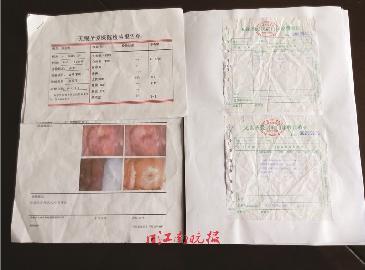 十块钱检查80%的妇科病,收了钱检查报告查不到