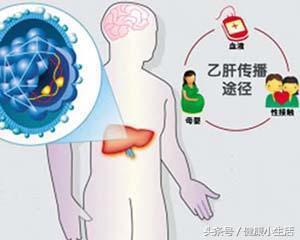 最经常母婴途径传播的病毒性肝炎,慢性乙型病毒性肝炎的传播途径