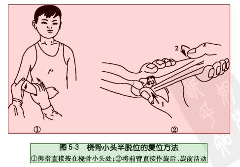 一岁半的宝宝肘关节脱位了怎么办,宝宝肘关节半脱位会影响今后吗