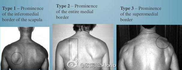 好体型练习动作,肩胛骨突出含胸驼背怎么治疗
