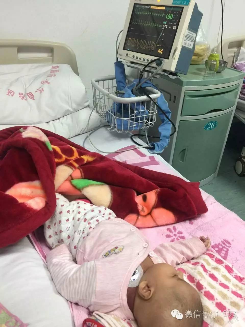 女婴出生26天得罕见病,维吾尔族女婴