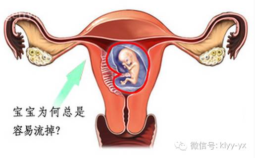 产后保健做好以下这７点，流产后仍可好孕！