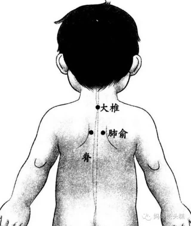 孩子染上慢性鼻炎手术根治外又一个有效方法！