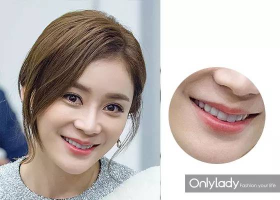 女子花4万块整容把嘴都整歪了,美国女子花76万整容