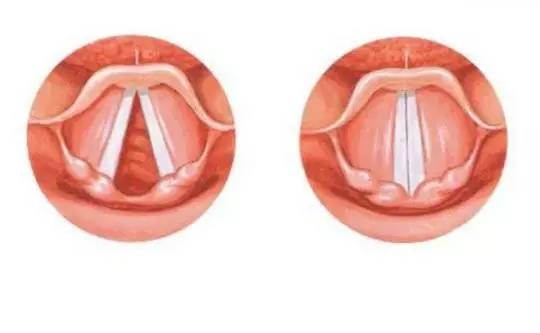 为什么哭的时候喉咙紧,为什么哭的时候喉咙很累