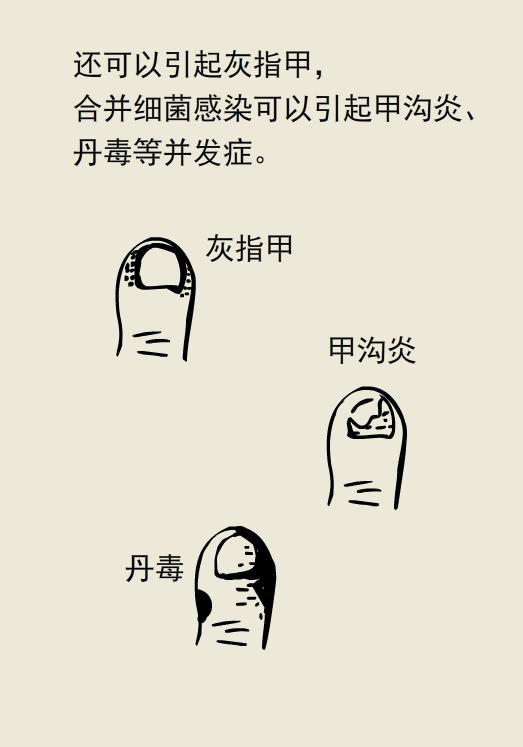 脚很臭不痒不脱皮是脚气吗,脚有脚气特别臭特别痒