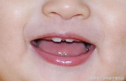 婴儿牙缝宽能塞硬币吗,宝宝牙缝宽能塞硬币吗