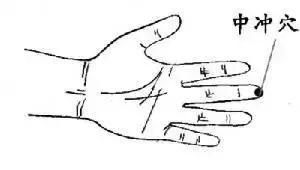 健康养生怎么调理便秘,科学运动改善便秘的方法