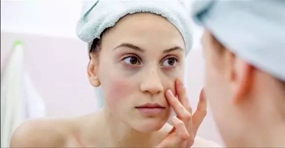 放疗后脸部水肿消肿最快方法,脸肿眼睛肿怎么快速消肿