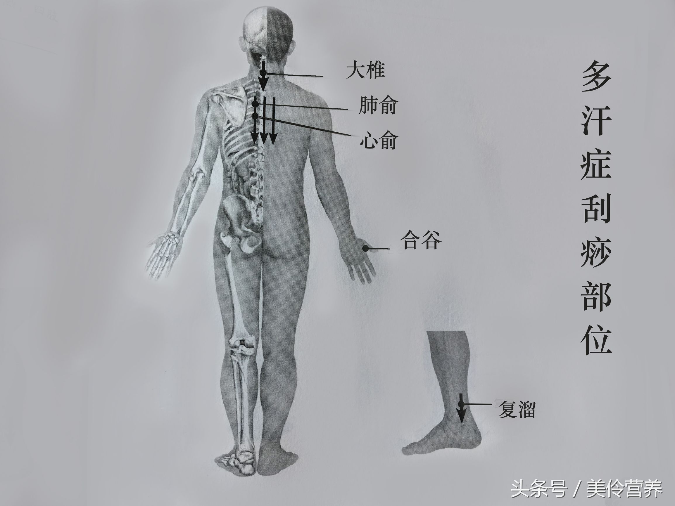*褐斑黄**、多汗症、多形红斑的刮痧疗法