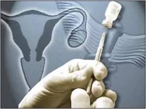 hpv疫苗在美国预约,美国的hpv疫苗男女都是免费的吗