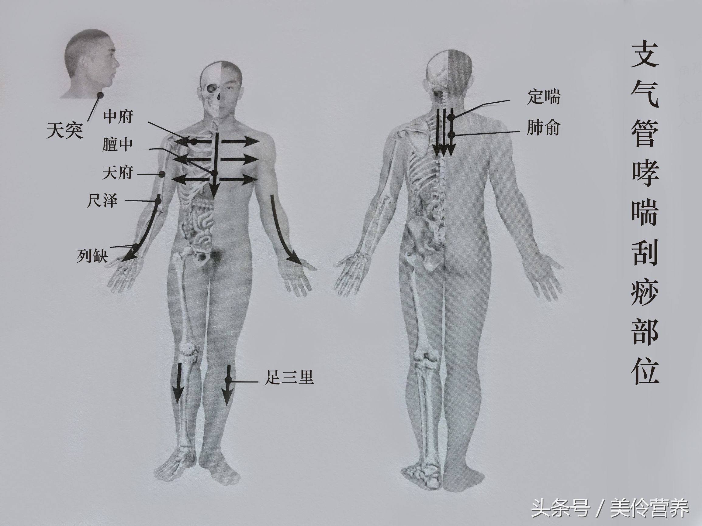 支气管炎穴位刮痧视频,支气管炎咳嗽刮痧哪里效果最快
