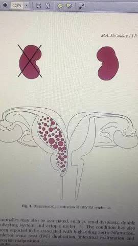 男子被女子抢金店,男子抢劫珠宝店被女店员打