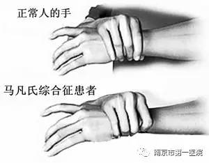 17岁少年心脏病手术,小女孩做了4次心脏手术