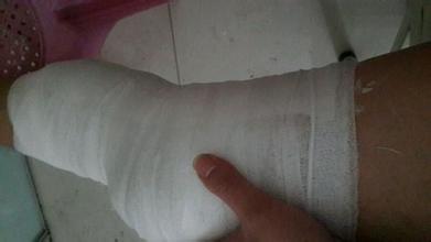 半月板科普儿童,半月板健康知识