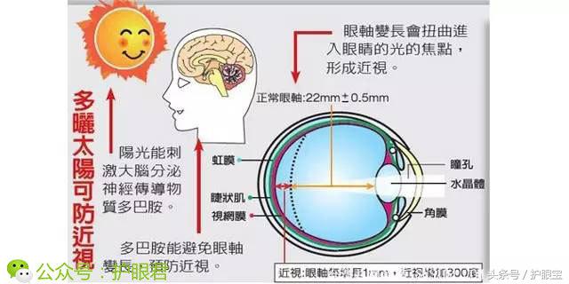 有什么办法可以免费解决近视,治疗近视眼自然疗法