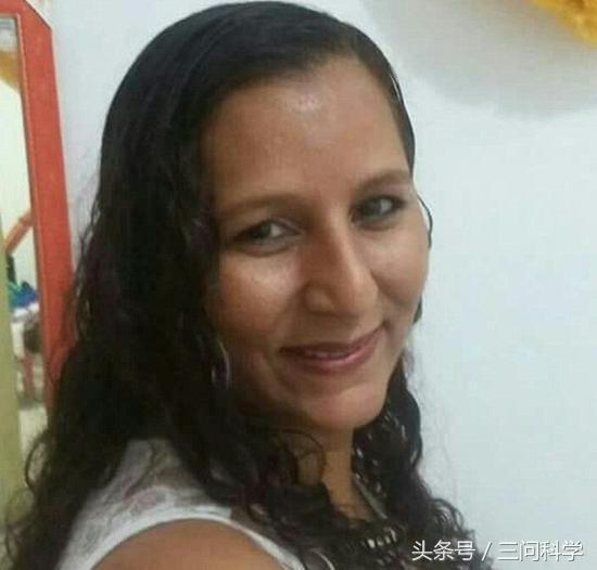 烫伤了不痛,鱼皮治疗烫伤疤痕可以吗