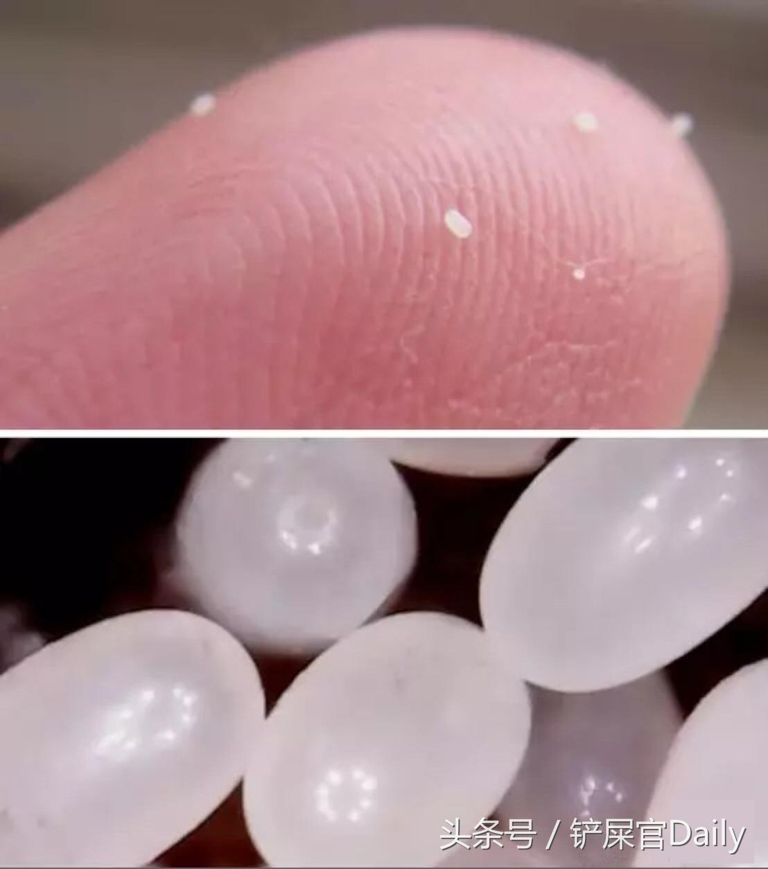 宠物身上有跳蚤寄生虫怎么办,宠物常见寄生虫