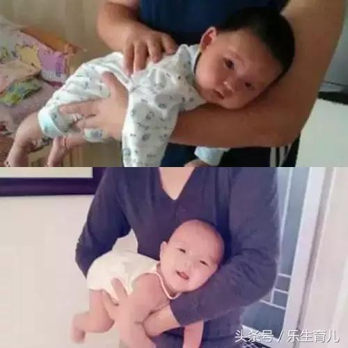 头丑随一生!千万别错过宝宝头型矫正黄金期