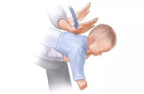 小孩吃东西噎住急救方法图,小孩吃瓜子噎死