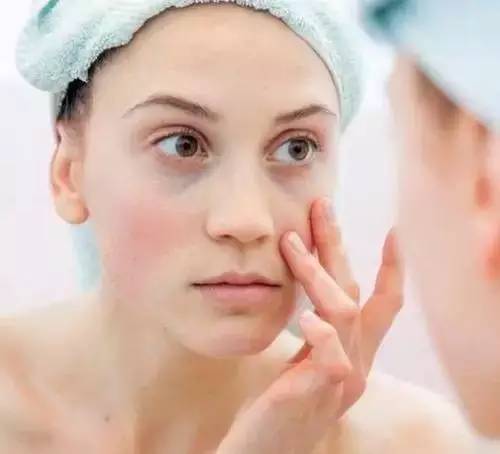 这7个方法迅速缓解你的黑眼圈,9大秘籍轻松搞定黑眼圈