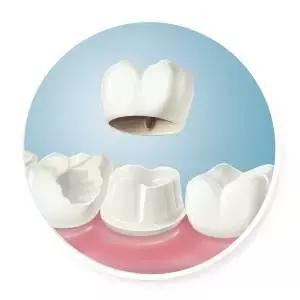 整牙=整容?看杨幂、刘涛、高圆圆为你亲身示范!