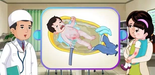 日常生活烧烫伤急救知识,烫伤后家庭急救知识