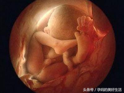 胎宝宝脐带绕颈是什么原因导致,37周胎儿脐带绕颈一周怎么纠正