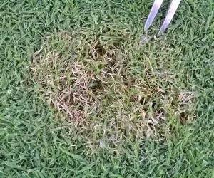 攻克白化病,攻克血友病