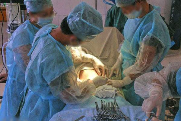 上次剖宫产仅14个月后又怀孕,有一次剖宫产经历还可以顺产吗