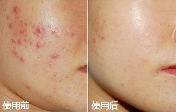 旅行必备100个护肤品,旅行必备物品清单及注意事项