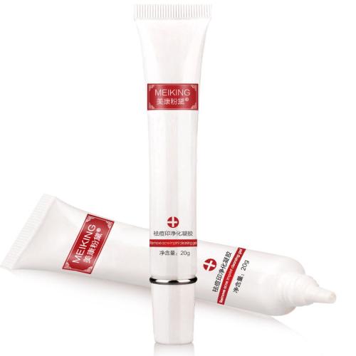 祛痘不盲目从了解长痘原因入手,战痘多年没有效如何正确祛痘