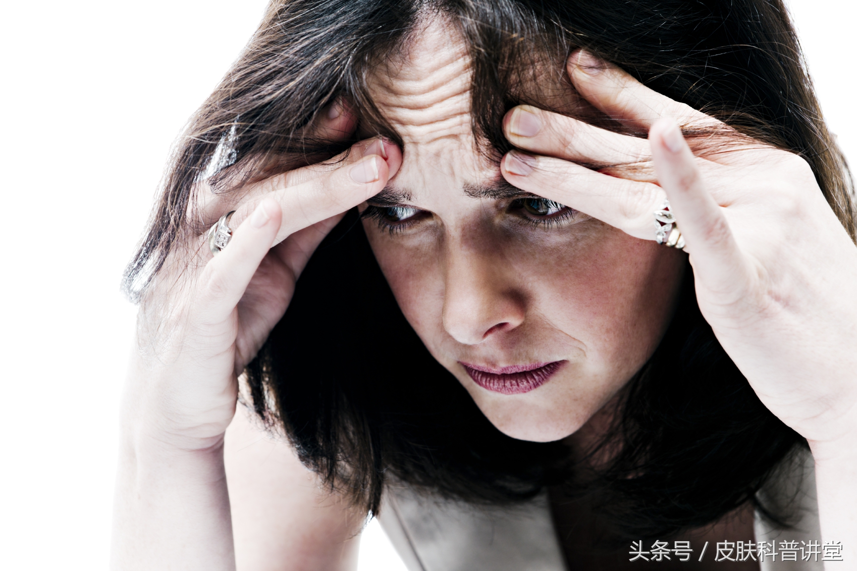 反复神经性皮炎是缺什么,神经性皮炎反反复复如何根除