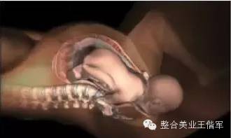 拒绝产后大肚腩轻轻松松搞定,盆腔臀疗手法