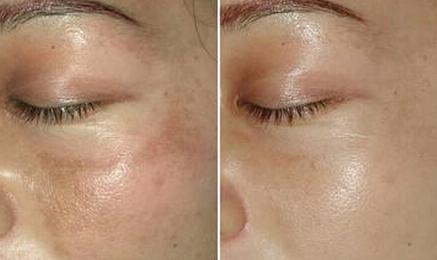 厨房中这两样东西对失眠有奇效,厨房里拿两样东西能减肥