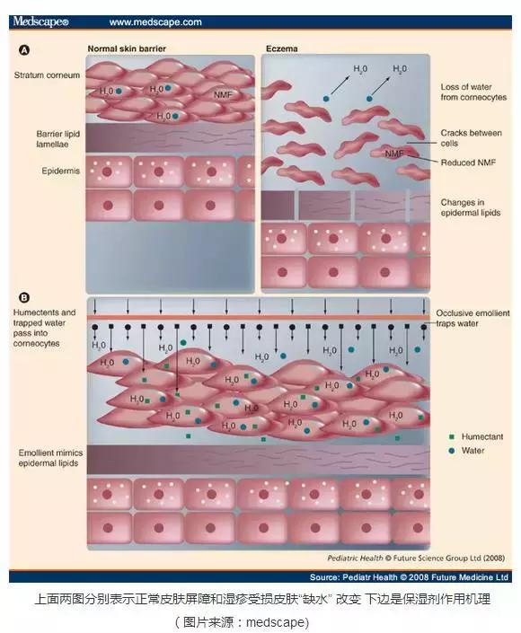 湿疹用肤乐霜怎么越用越多,肤乐霜可以根治湿疹吗
