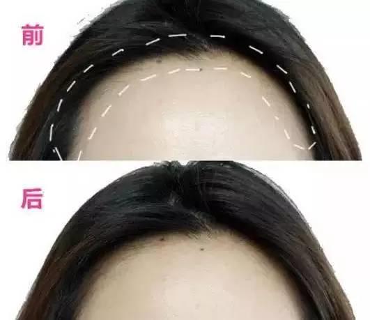 大幂幂凸显发际线,大幂幂发际线高