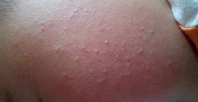 宝宝出现这些生理“异常”现象，你被哪个吓到了？