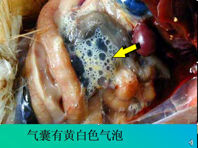 治疗支气管堵塞最好方法,支气管堵塞和气囊炎区别