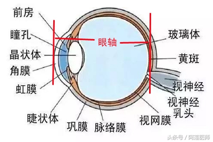 远视性近视是怎么造成的,怎样解决近视加远视的问题